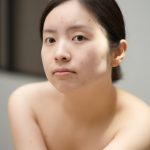 Pre-Formulated Lotion: Acne-Prone Skin